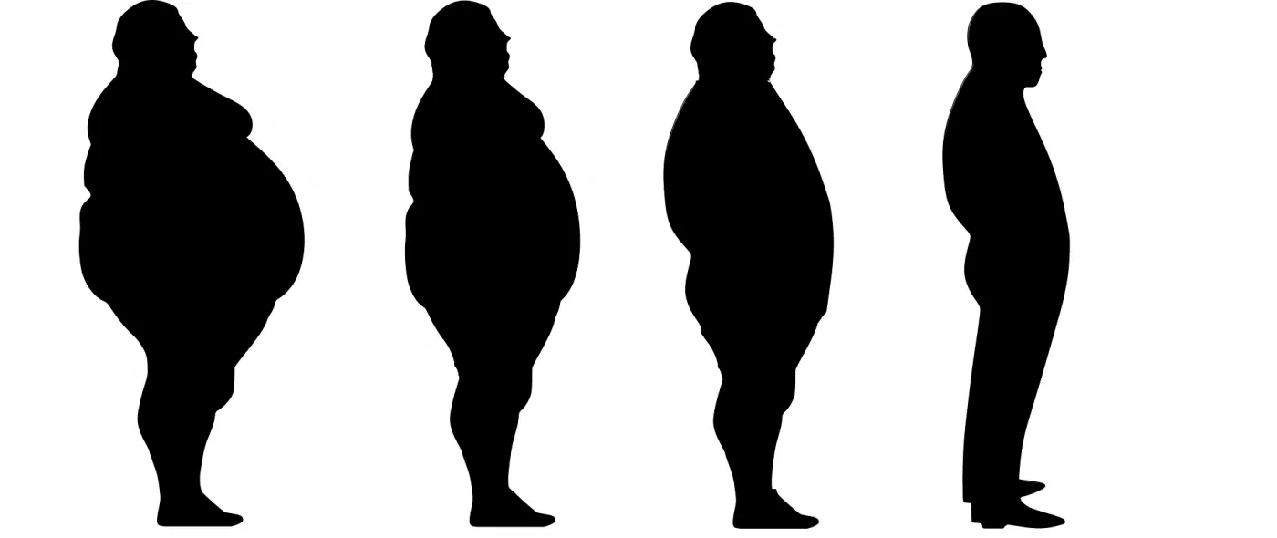 Gewichtsreduzierung und Abnehmen bei Fettleibigkeit und starkem Übergewicht